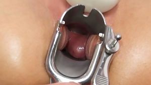 Triple orgasm with a speculum inside vagina